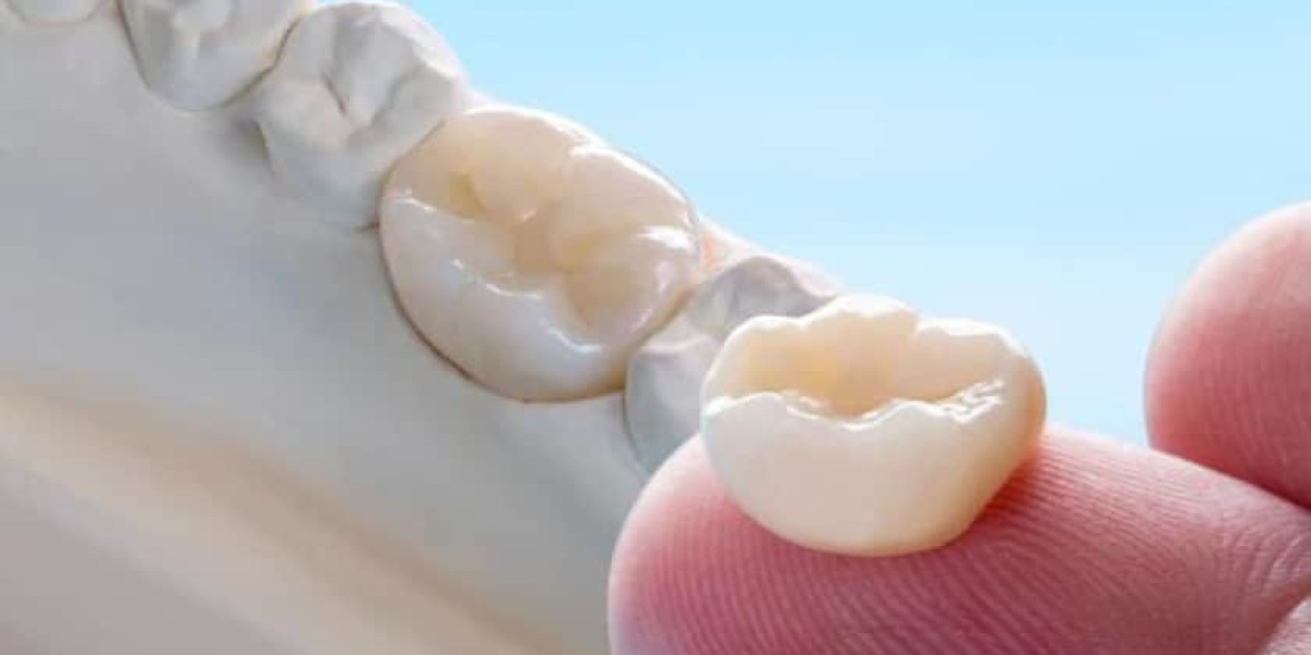 Enhancing Smiles: A Comprehensive Guide to Porcelain Crowns in the UK