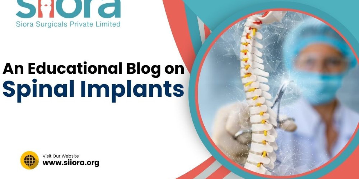 An Educational Blog on Spinal Implants
