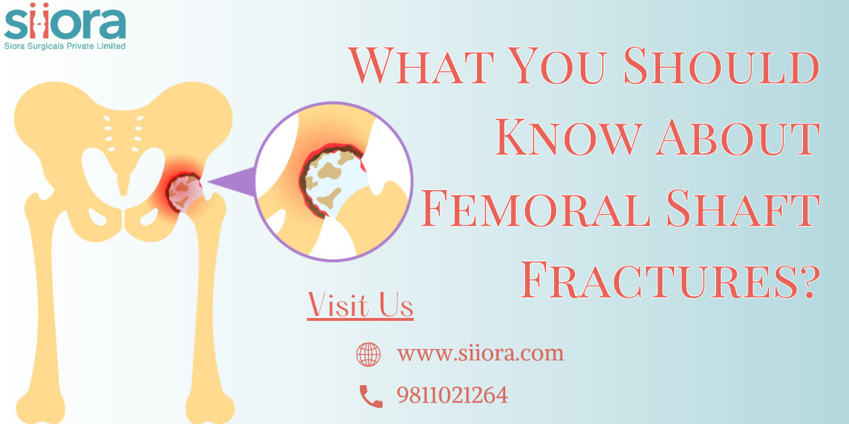 What You Should Know About Femoral Shaft Fractures?