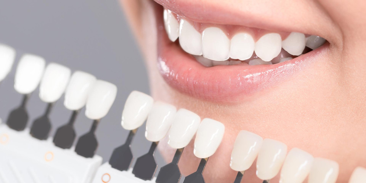 The Ultimate Guide to Finding the Best Orthodontist in Etobicoke