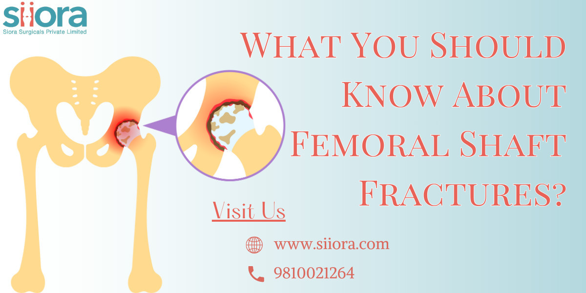 What You Should Know About Femoral Shaft Fractures?