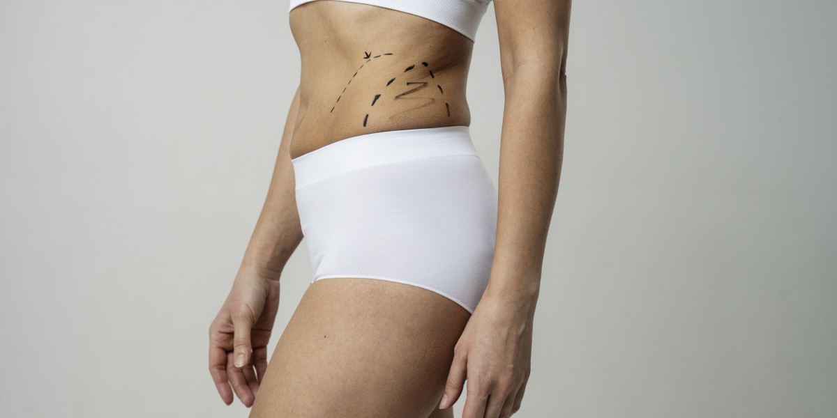 Liposuction A Gateway to Self Love and Acceptance in Dubai