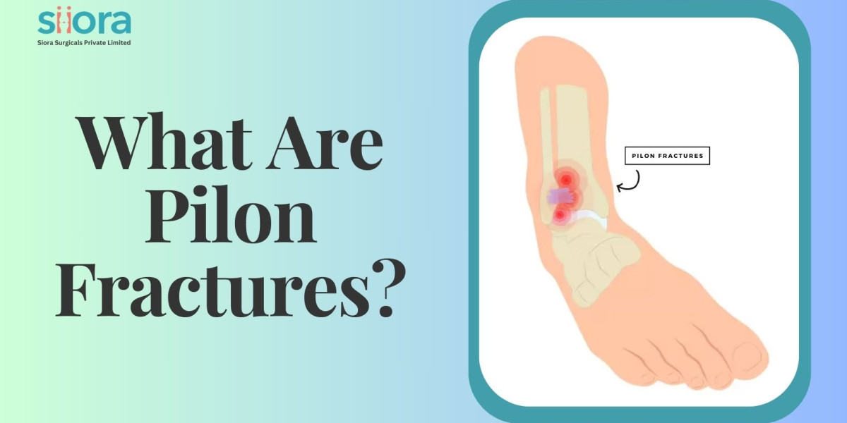 What Are Pilon Fractures?