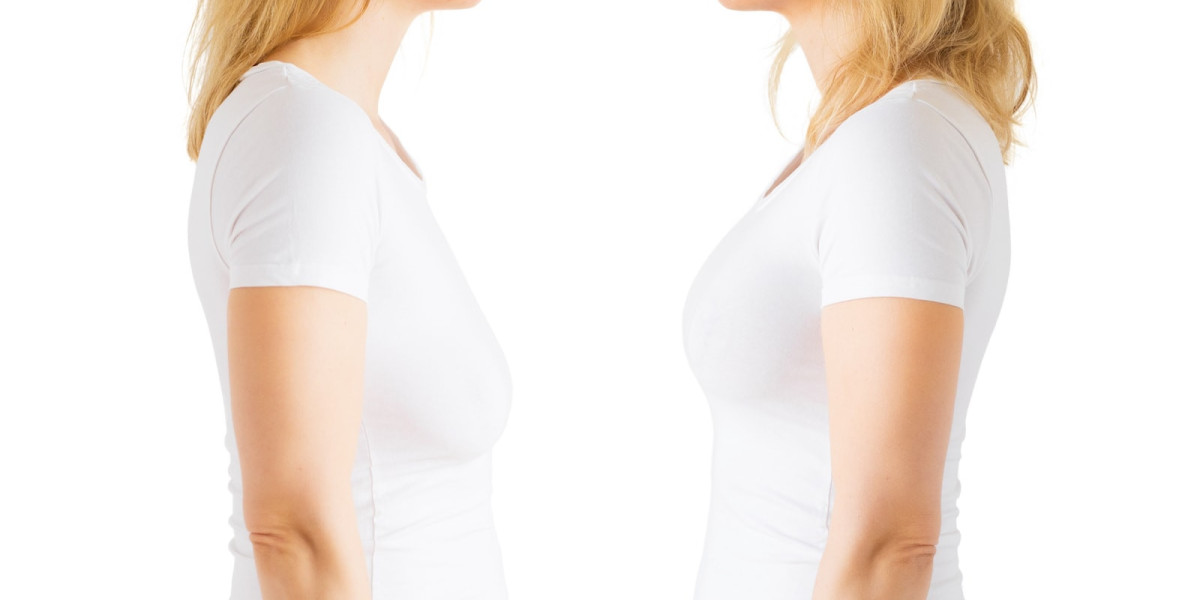 Hidden Costs of Breast Lift Surgery in Dubai: Be Aware Before You Commit