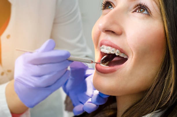 How to take care of your braces the right way?