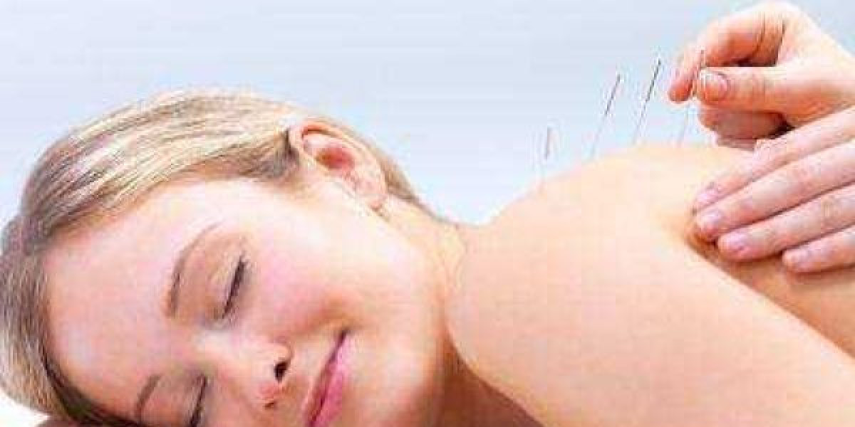 What Makes Acupuncture for Low Back Pain in Morristown a Popular Choice?