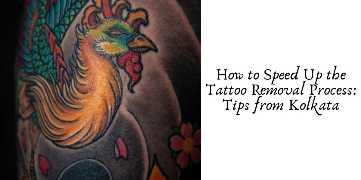 How to Speed Up the Tattoo Removal Process: Tips from Kolkata