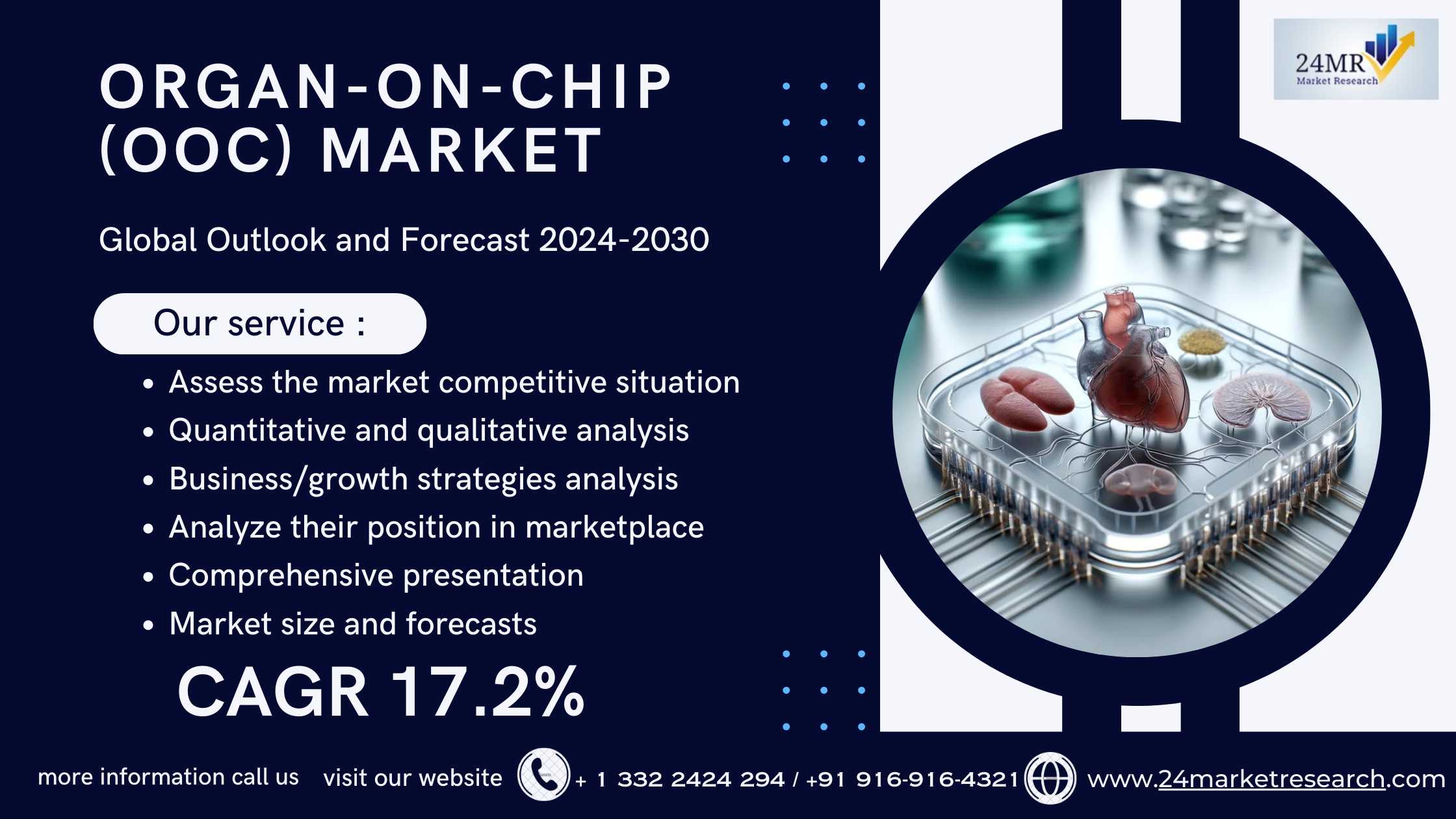 Organ-On-Chip (OOC) Market, Global Outlook and For..