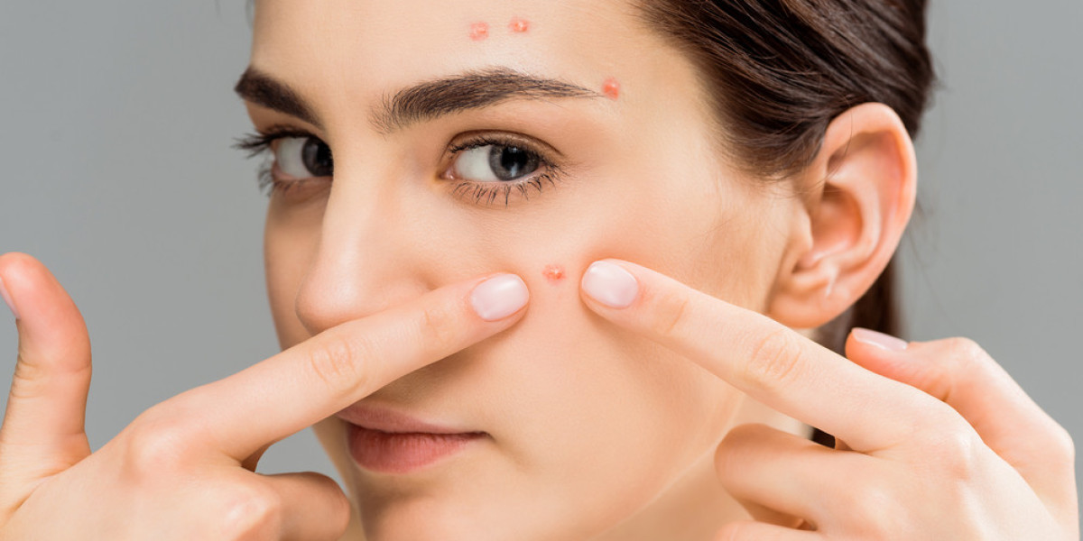Acne Medication Market Growth Analysis and Forecast till 2031