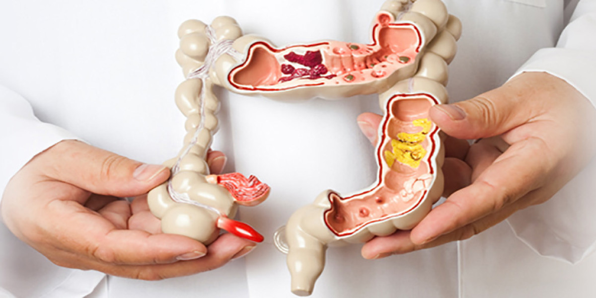 Top 5 Colorectal Surgeon in Mumbai You Need to Know About Right Now!