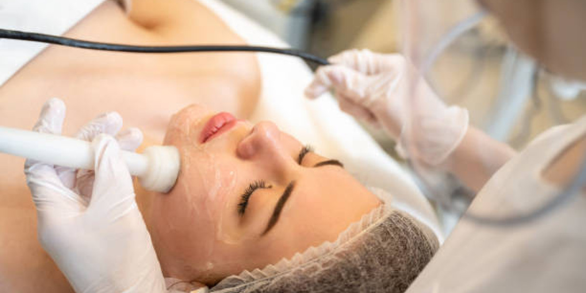 5 Benefits of Radio Frequency Skin Tightening You Need to Know in 2024