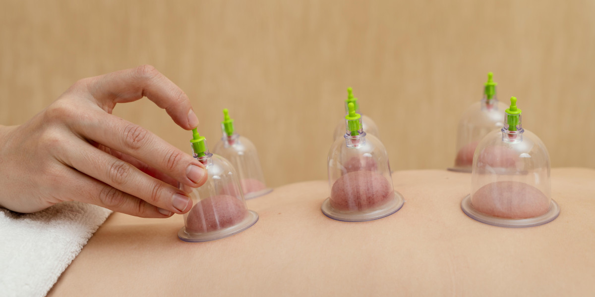 Exploring the Ancient Art of Cupping Therapy in Las Vegas